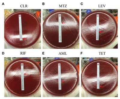 Antibiotic Resistance of Helicobacter pylori Strains Isolated From Pediatric Patients in Southwest China